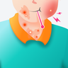 Vắc xin phòng Sởi Quai bị Rubella